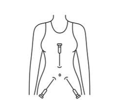 Female breast, piles, hernia, surgery & laparoscopy  specialist